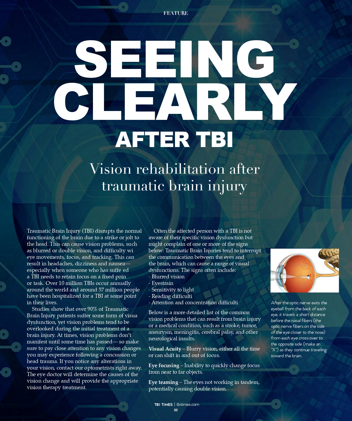 Seeing Clearly after TBI